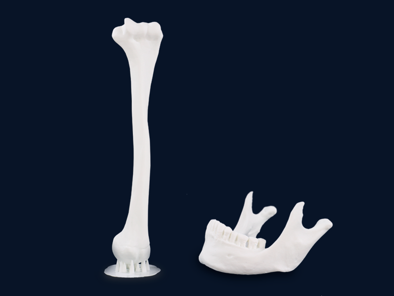 Medical models 3D printed with the Premium White resin